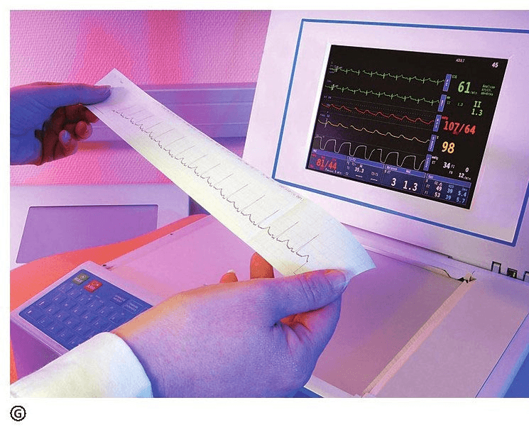 Perché il cuore produce un ECG?